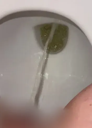 Ich setze mich falsch herum auf die Toilette, pisse und wische mich ab