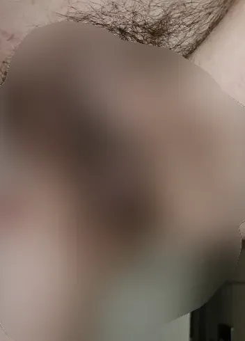 Schleimige möse muss sich entleeren